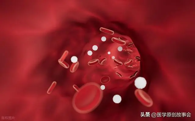 人有没有血栓，睡觉就知道？体内有血栓的人，睡觉常有这4个表现