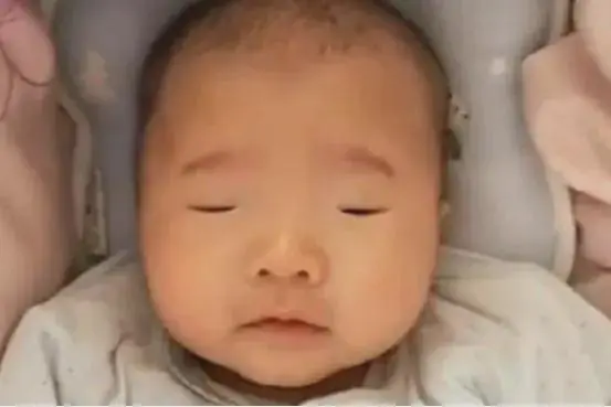 孩子出生“没眼睛”，家长慌忙带孩子就医，医生检查完却笑了