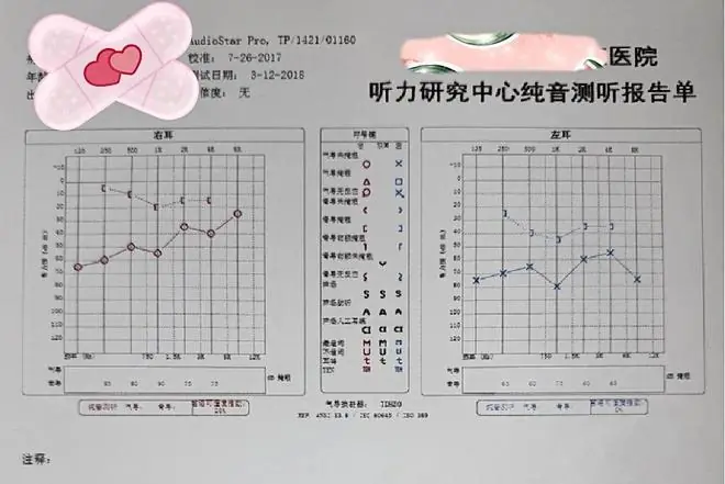 28岁女子一出生就患怪病，半边身体长满“苔藓”，每次长高发病越狠，腿跛了左耳聋了左眼也几近失明，最终被确诊罕见病
